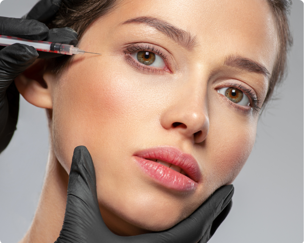 Botox preventivo