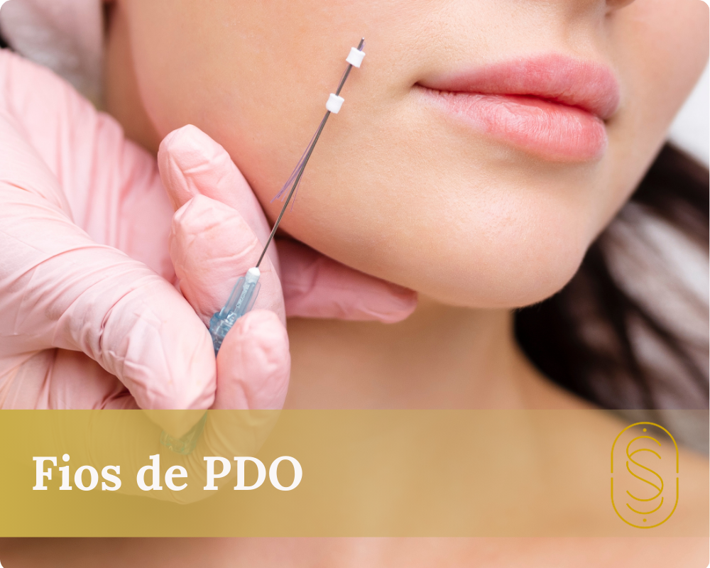 Fios de PDO